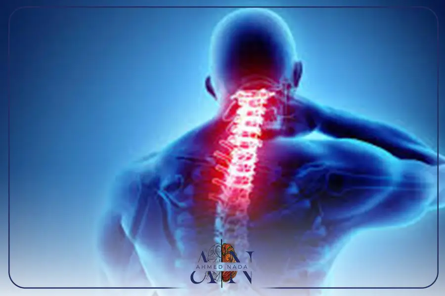 اسباب الانزلاق الغضروفي العنقي