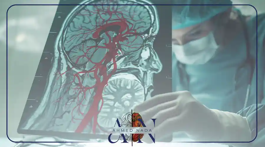 اشهر دكتور مخ واعصاب في القاهره