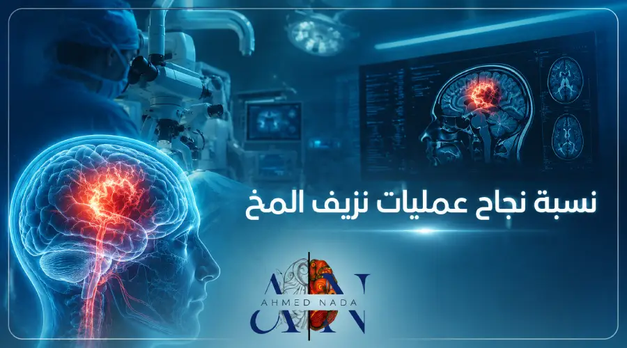 نسبة نجاح عمليات نزيف المخ