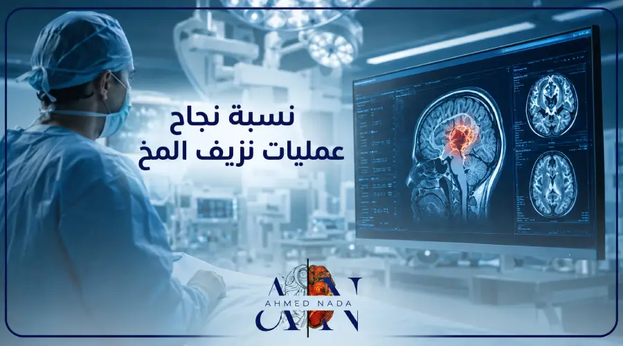 نسبة نجاح عمليات نزيف المخ